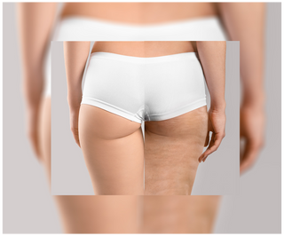 Cellinea tablets for cellulite and improving skin condition with natural extracts 60 capsules