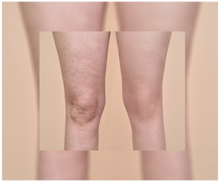 Cellinea tablets for cellulite and improving skin condition with natural extracts 60 capsules