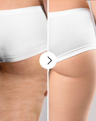 Cellinea tablets for cellulite and improving skin condition with natural extracts 60 capsules_3 - 3