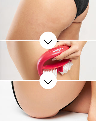 Crush my Celloo anti-cellulite massager with nubs to fight cellulite and reduce muscle tension - 3