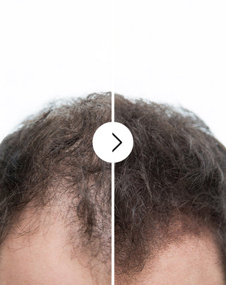 Follixin capsules for hair loss with a thickening and strengthening effect 60 capsules_2 - 2