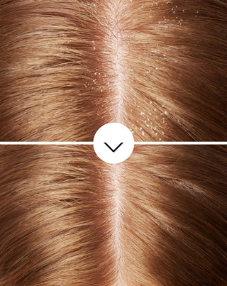 Nutridome anti-dandruff shampoo with piroctone olamine with a moisturising effect - 3