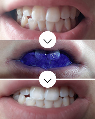 White Bite Smilebite tooth color correcting serum 30 ml - 3