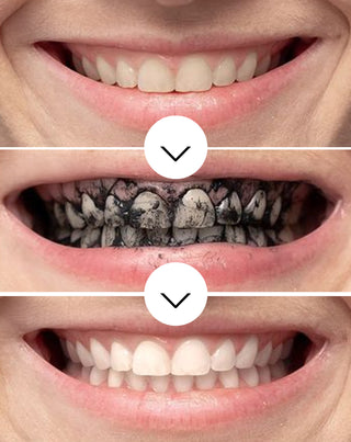 Smilebite coconut charcoal teeth whitening powder - 4