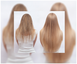 Follixin capsules for hair loss with a thickening and strengthening effect 60 capsules