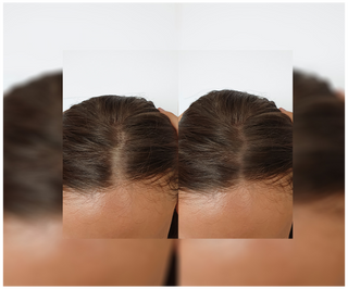 Follixin capsules for hair loss with a thickening and strengthening effect 60 capsules - 6